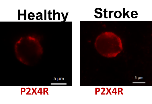 Stroke medicine cells