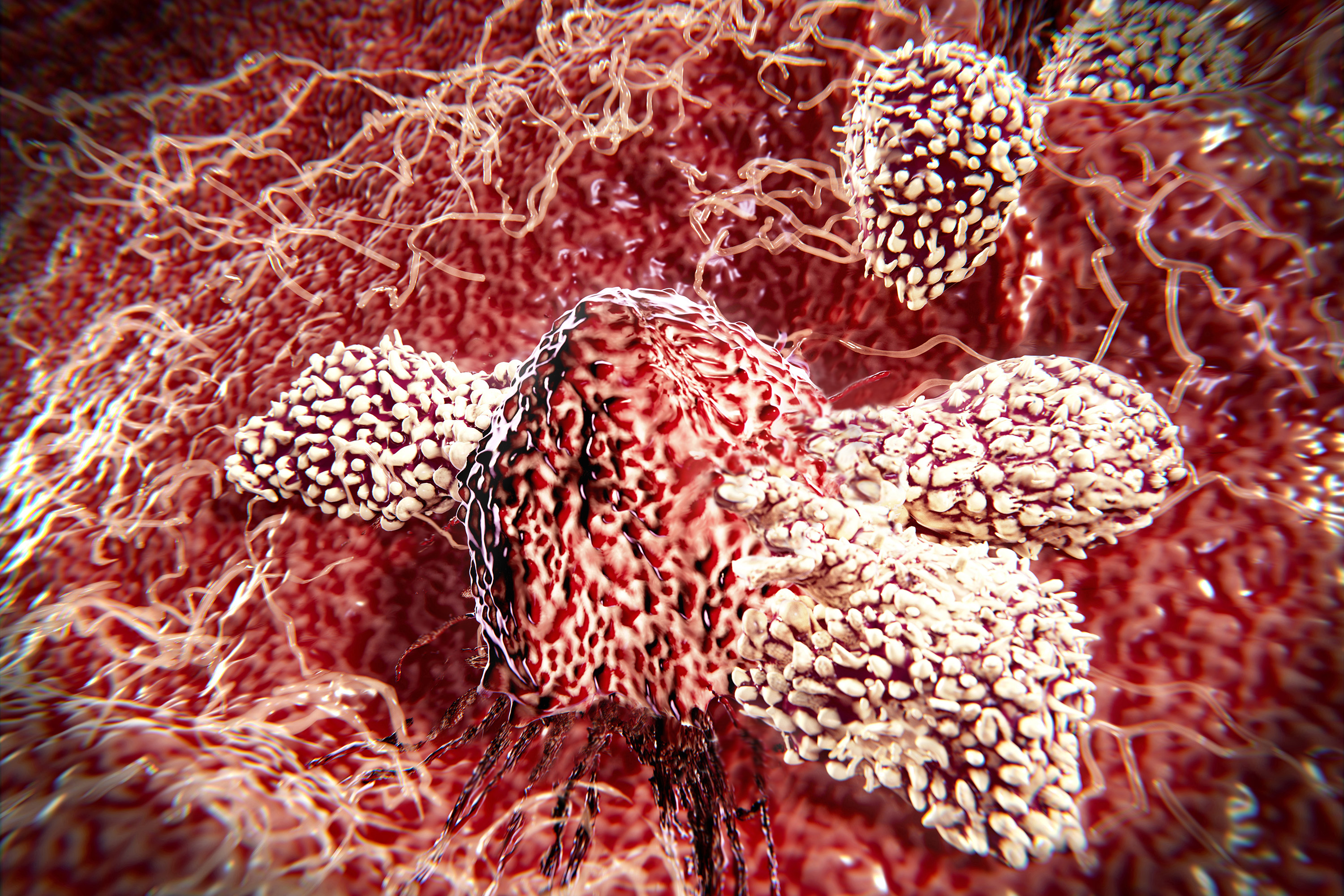 Computer illustration of cytotoxic T-lymphocytes attacking a cancer cell. (Juan Gaertner/Science Photo Library via Getty Images)