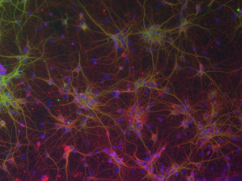 Control cultures from Min Tang-Schomer's lab where neurons are grown in vitro with electrode stimulation. (Min Tang-Schomer, UConn Health)