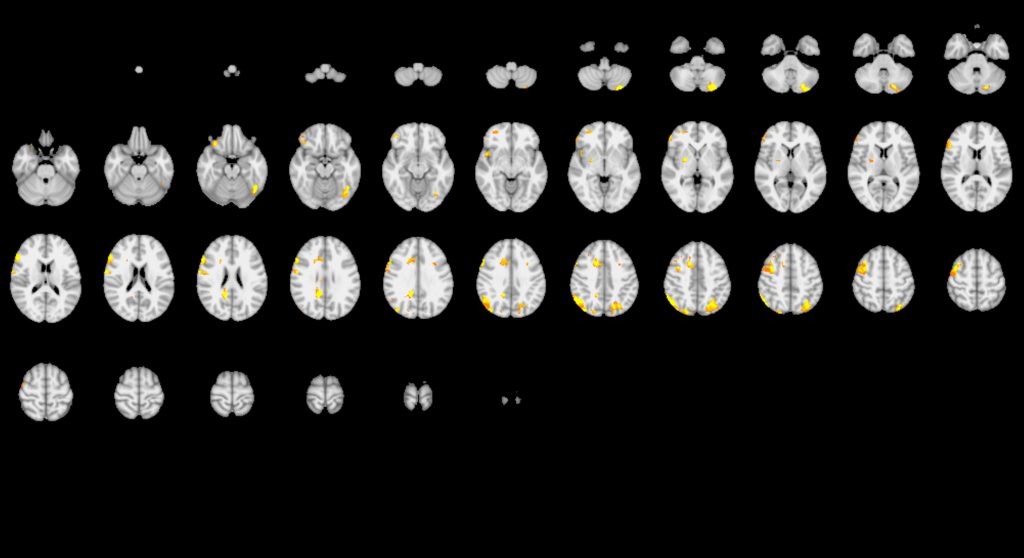 Two sets of imagery from brain analyses