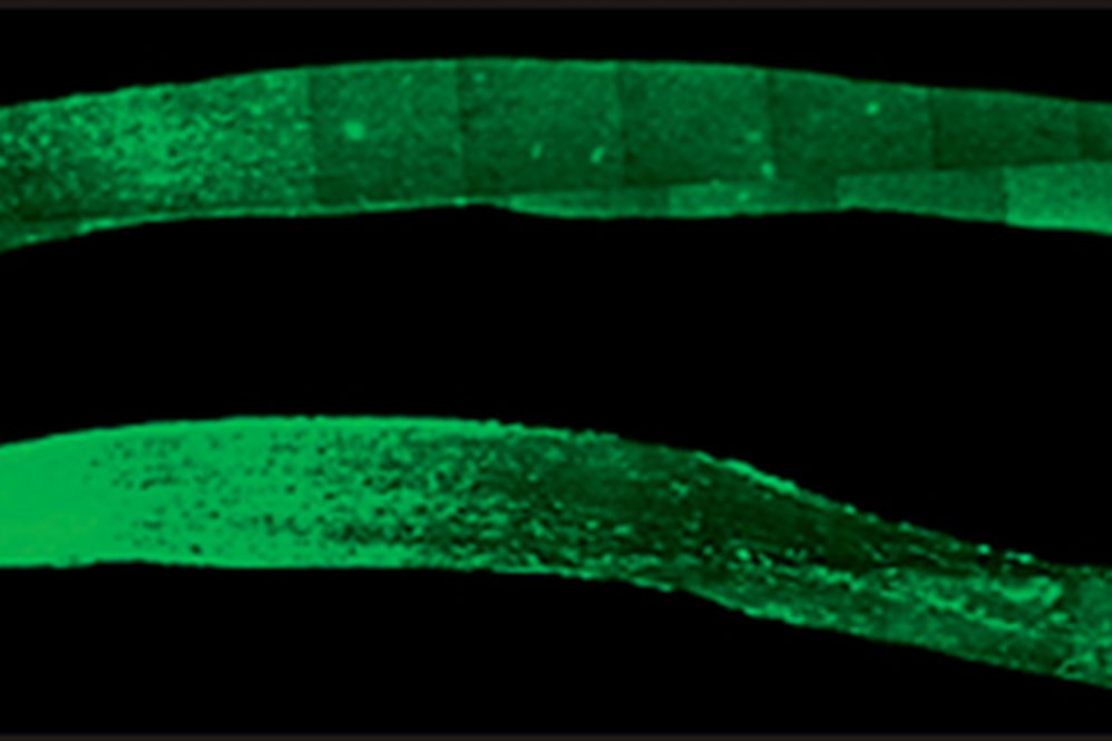 Images show two optic nerves